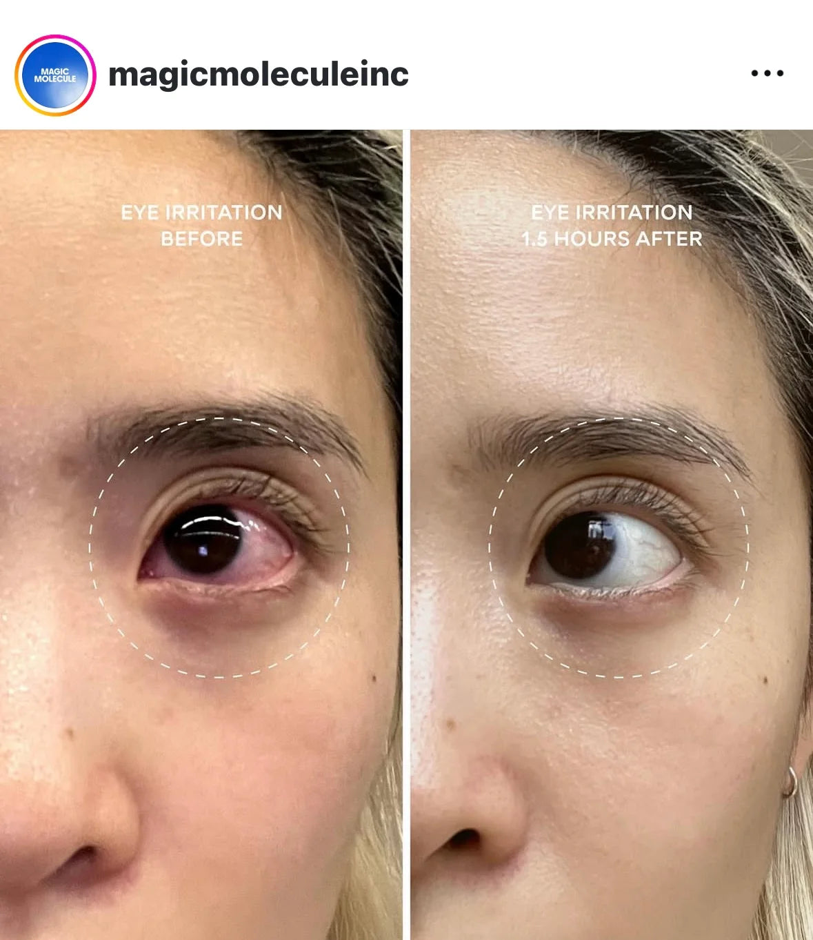 Magic Molecules 8oz Antimicrobial Hypochlorous Acid Skin Spray